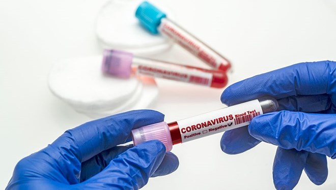 15 Haziran 2021 koronavirüs tablosu: 84 can kaybı, 5 bin 955 yeni vaka