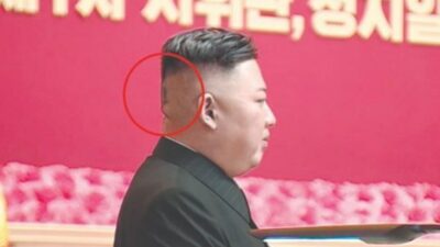 Kim’e ne oldu? Sağlığı hakkındaki tartışmalar arttı