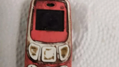 Doktorları şaşırtan ameliyat: Midesinden Nokia 3310 çıktı