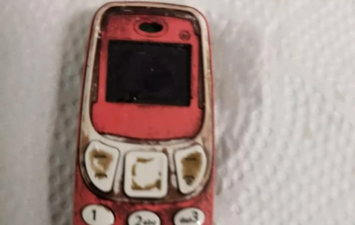 Doktorları şaşırtan ameliyat: Midesinden Nokia 3310 çıktı