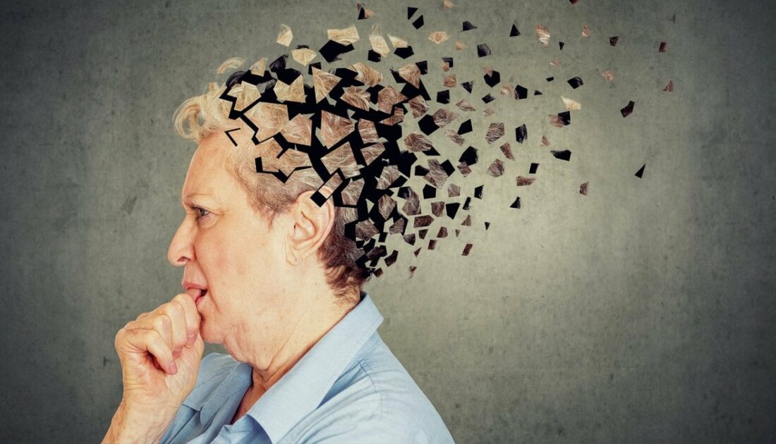 Alzheimer hastalığıyla ilgili çarpıcı gerçek ortaya çıktı